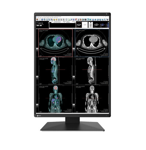 Περισσότερες πληροφορίες για "EIZO RadiForce RX370 (21.3"/Δεν υποστηρίζεται)"